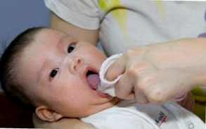 Как проявляется молочница у детей во рту фото