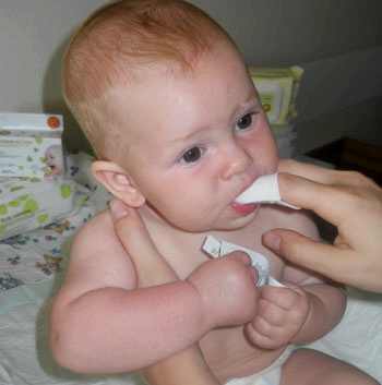нарыв во рту у ребенка лечение