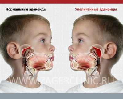 лечение нефропатии у детей в москве