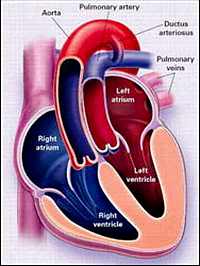 ревматические пороки сердца у детей