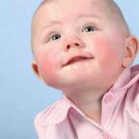 конъюнктивит у ребенка 6 месяцев чем лечить