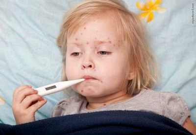 прививка от краснухи детям делать или нет